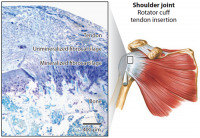 Illustration showing location of rotator cuff tendon insertion and microscopic view of the enthesis